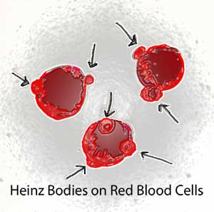 Red blood cells showing heinz bodies by Susan Fluegel at Grey Duck Garlic